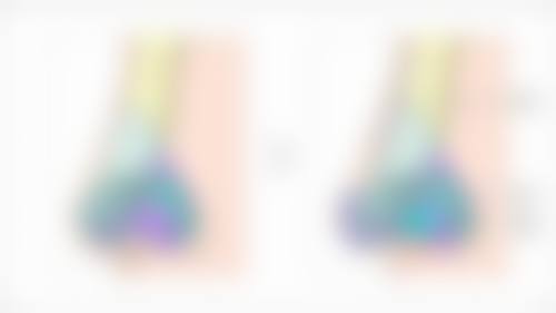 {眼袋不小心碰肿了怎么办？应急处理与医美改善方案助你快速消肿恢复