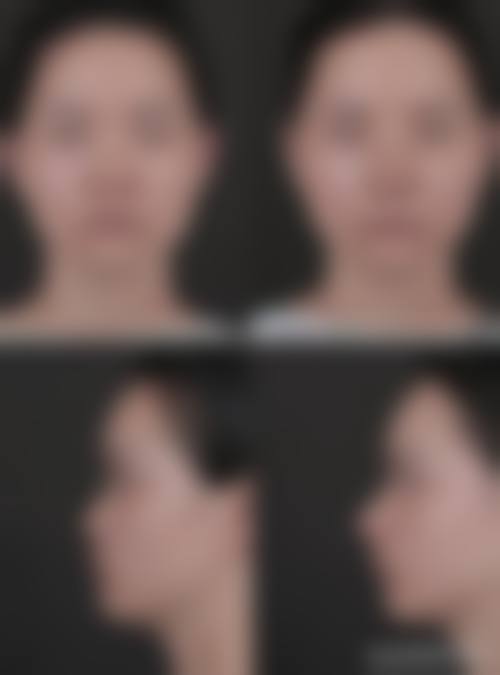 二、北京紫洁俪方医疗美容医院怎么样？