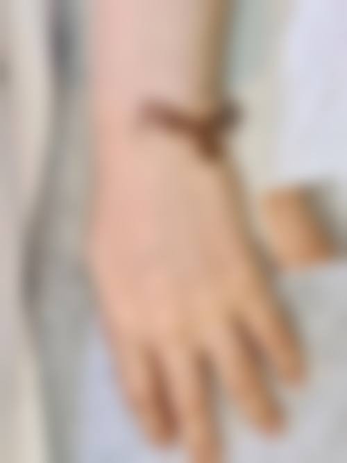 八、清华大学第一附属医院(皮肤美容科)预约方式