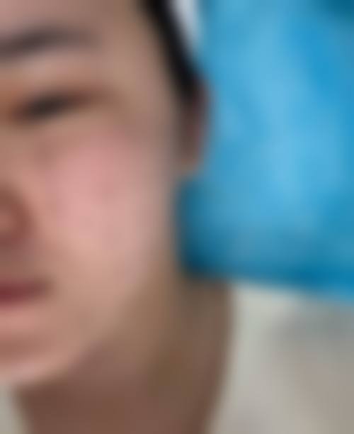 三、清华大学第一附属医院(皮肤美容科)诊疗项目有哪些？