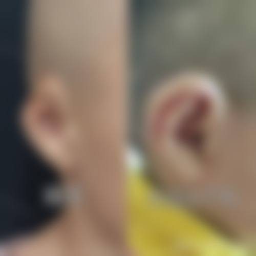 六、北京紫洁俪方医疗美容医院价格表