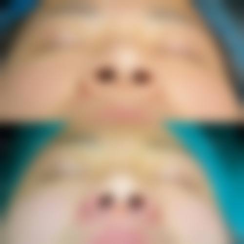 八、铁岭恒韵医学美容诊所真实的患者评价