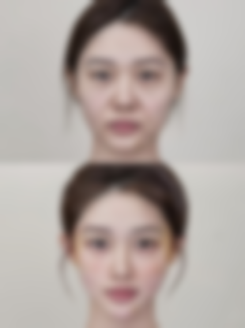 五、李斗荣怎么预约？