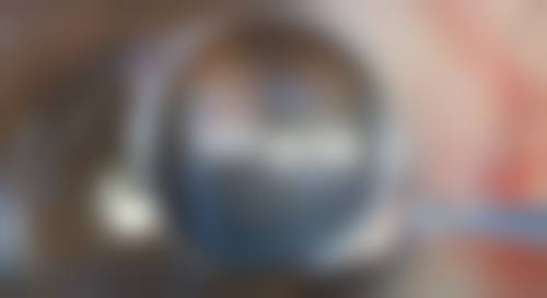 三、日常护理，辅助改善