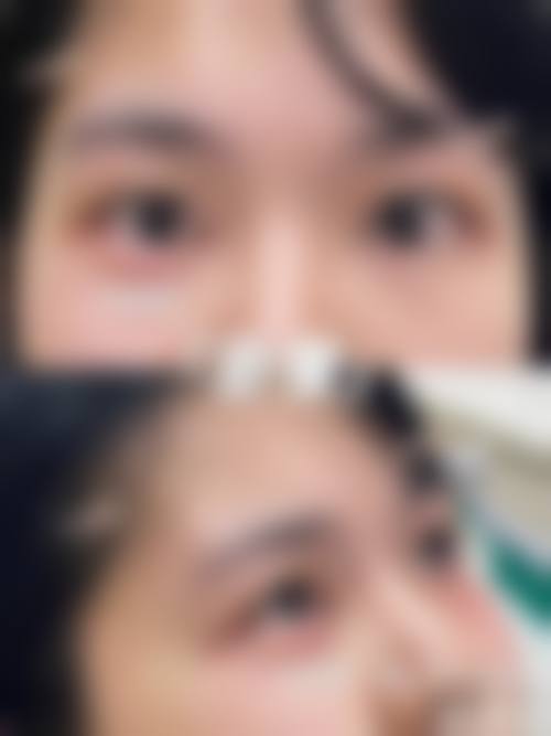 八、云南黛雅医疗整形美容真实的患者评价