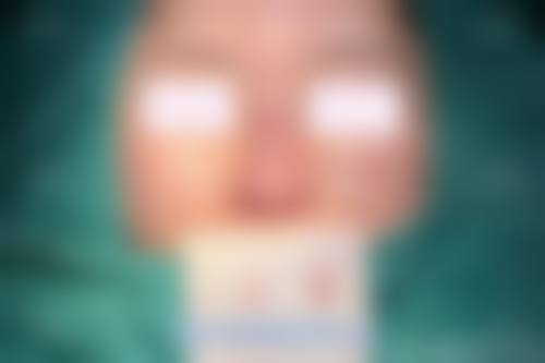 九、鹤壁美林苑整形医疗美容门诊部真实的患者评价