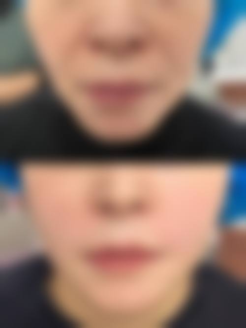 二、大同伊美康整形医院怎么样？