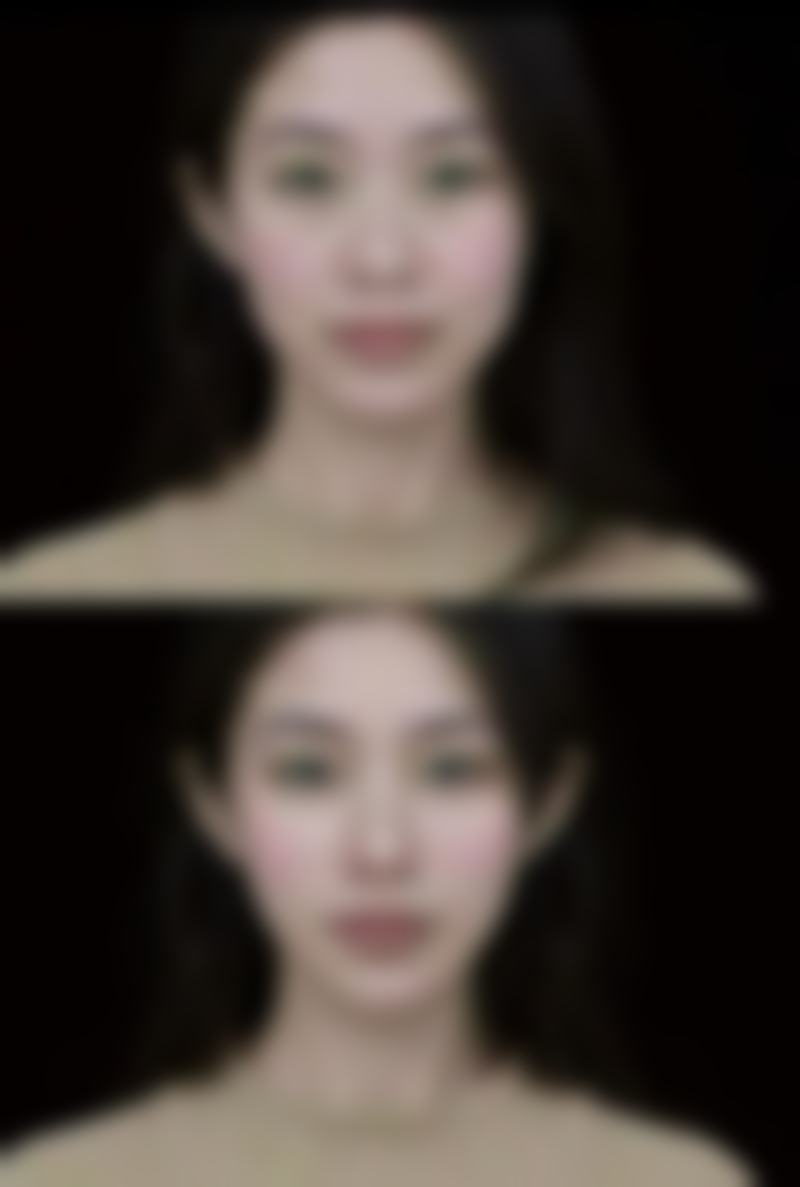 一、了解疤痕，找准方向