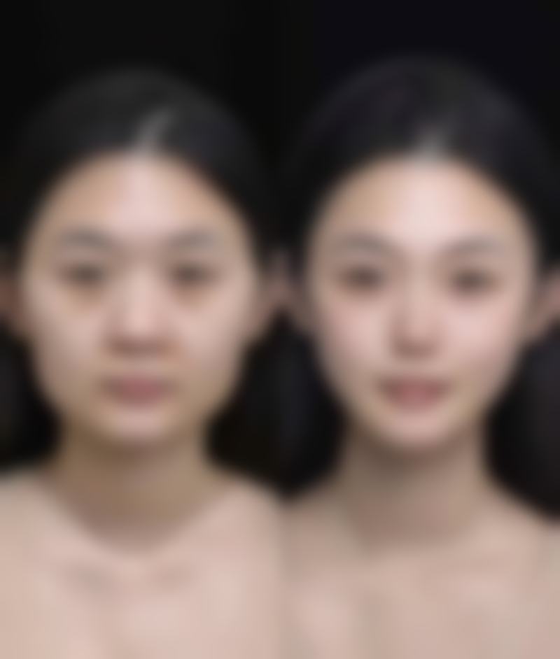 四、云南黛雅医疗整形美容特色项目