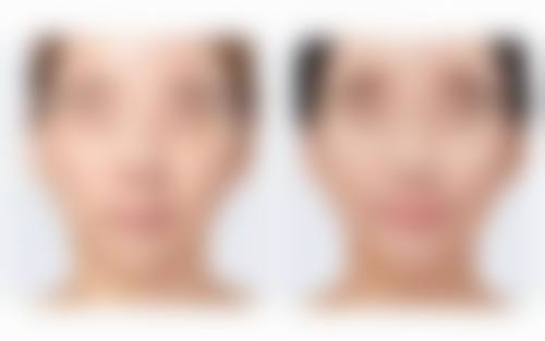 四、如何按摩才能祛掉眼袋：按摩与生活护理结合