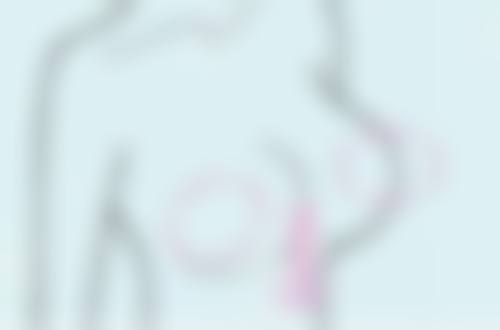 三、取出后鼻部状态的影响因素及应对措施