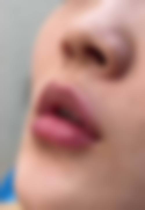 八、南宁美蒂菲（中科贝拉）医疗美容门诊部真实的患者评价