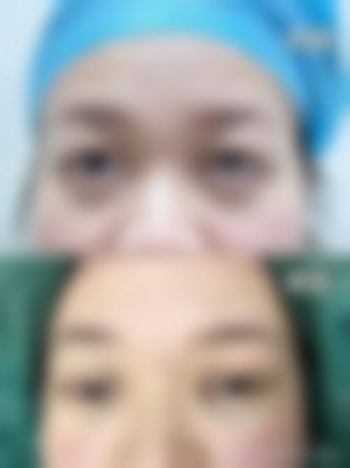 四、邯郸李婷整形外科医院特色项目