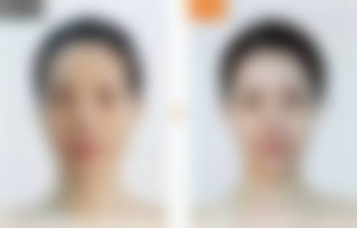 六、邯郸李婷整形外科医院价格表