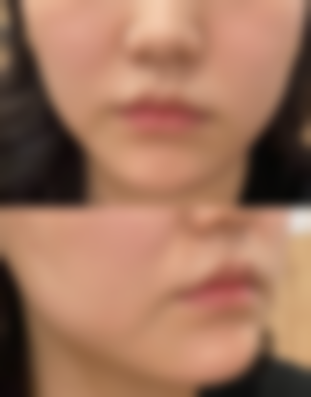 一、割完双眼皮可以吃薄荷糖吗:答案初揭晓