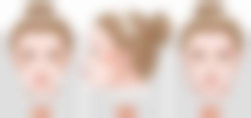 五、瘦脸针打一针有成效吗?维持时间大揭秘