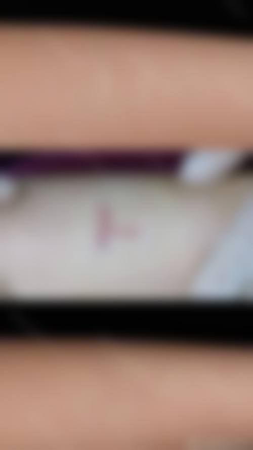 六、张家港市非常好人民医院烧伤整形科价格表