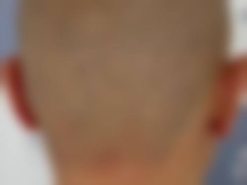 七、广州广二整形美容医院预约方式