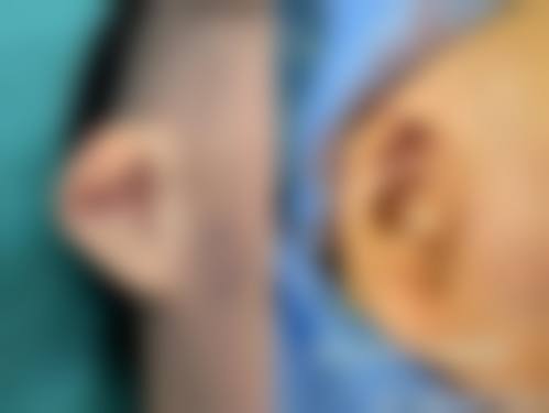 三、张家港市非常好人民医院烧伤整形科诊疗项目有哪些？