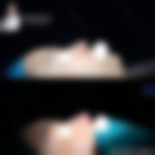 九、张家港市非常好人民医院烧伤整形科真实的患者评价