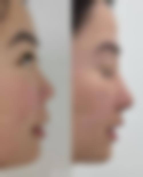 四、张家港市非常好人民医院烧伤整形科特色项目