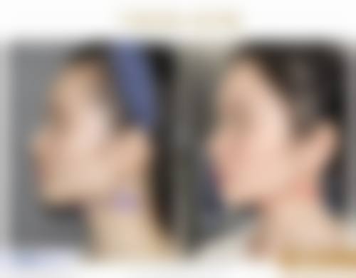 八、张家港市非常好人民医院烧伤整形科预约方式