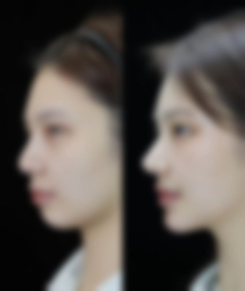 四、北京积水潭医院特色项目