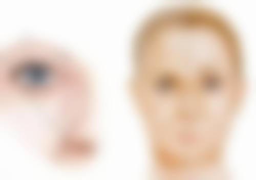 五、双眼皮眼角修复过程中的特殊情况处理