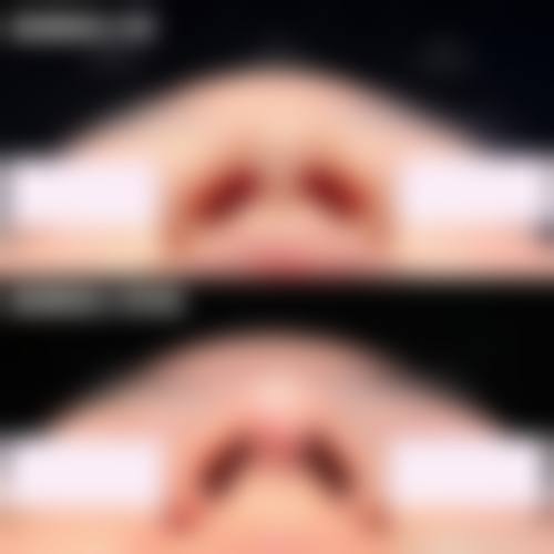 三、黄石市第五医院整形外科诊疗项目有哪些？