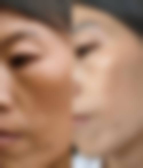 五、韩国丹雅皮肤科价格表