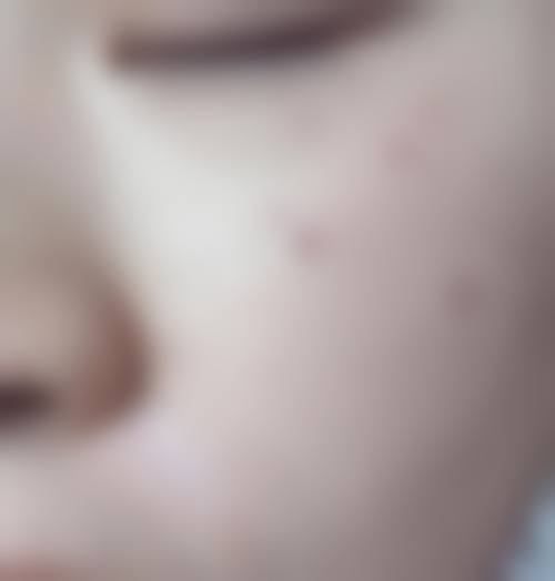 六、韩国丹雅皮肤科地址及交通