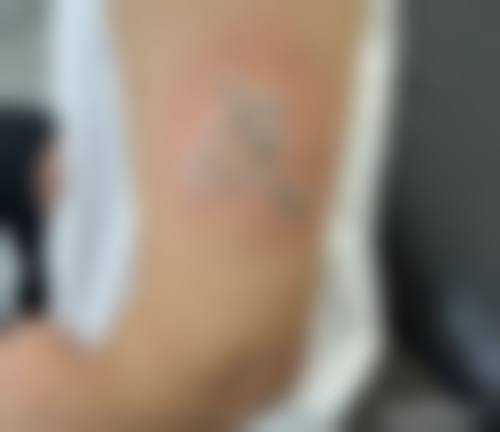 四、黄石市第五医院整形外科特色项目