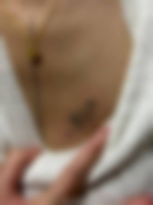 七、黄石市第五医院整形外科预约方式