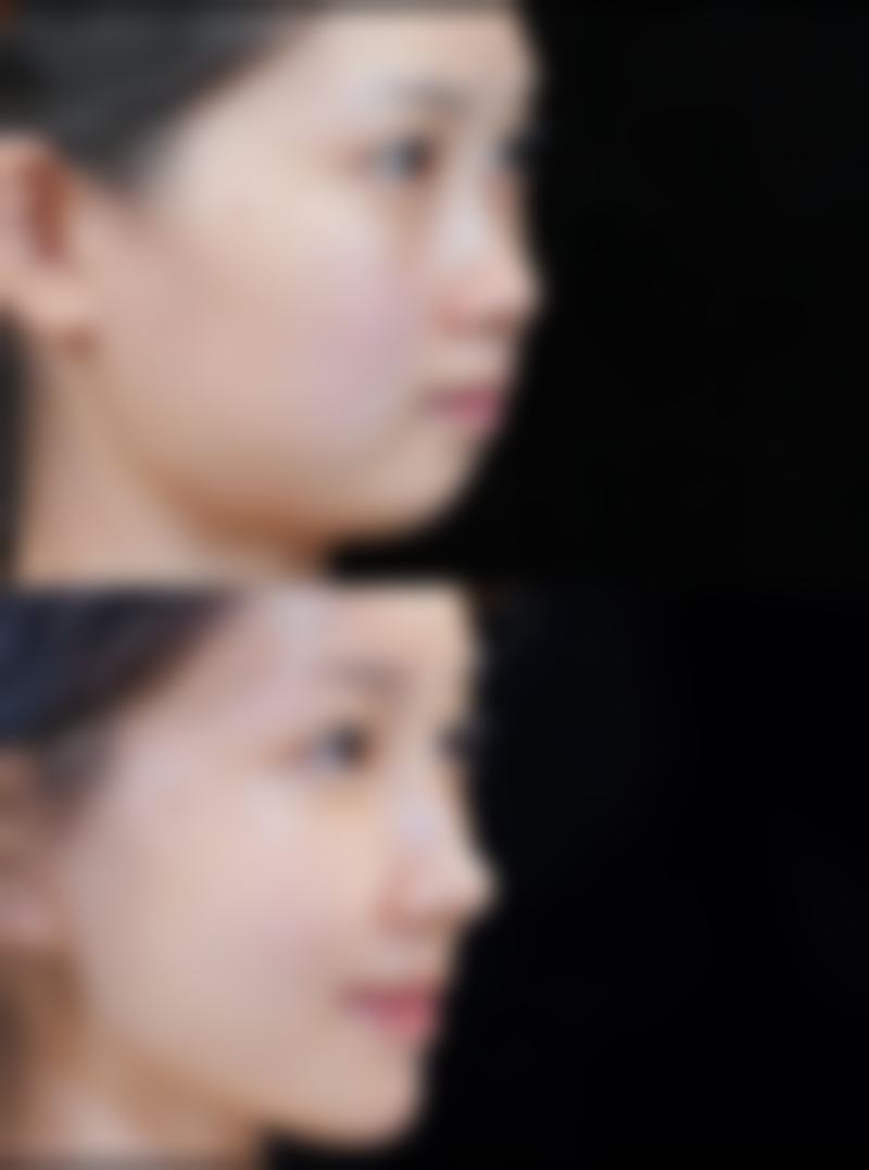 五、天津美高美辰医学美容门诊部价格表