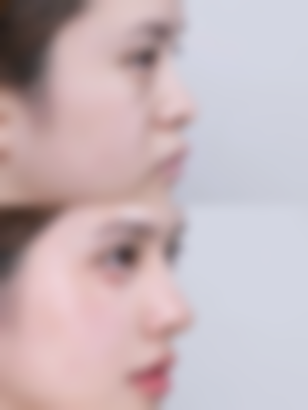 {韩式阴道紧缩术手术怎么紧缩？操作流程、术后护理及风险全解析 