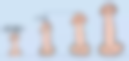 {割的双眼皮有疤怎么办？分型处理、科学护理助你有效淡化疤痕恢复自然美