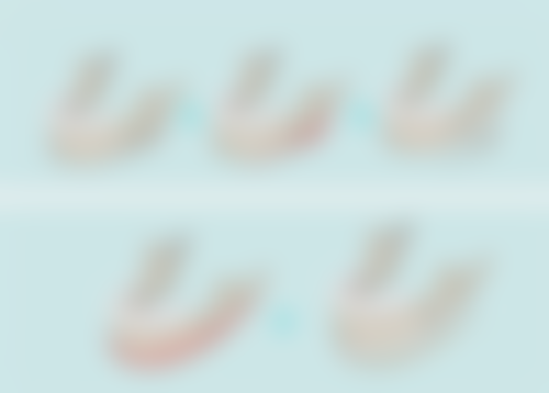 二、割的双眼皮疤痕的类型及对应处理方案