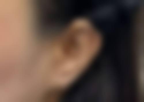 三、天津芊沐整形医院诊疗项目有哪些？