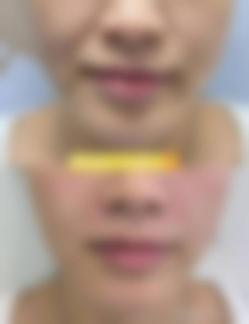 八、天津芊沐整形医院真实的患者评价