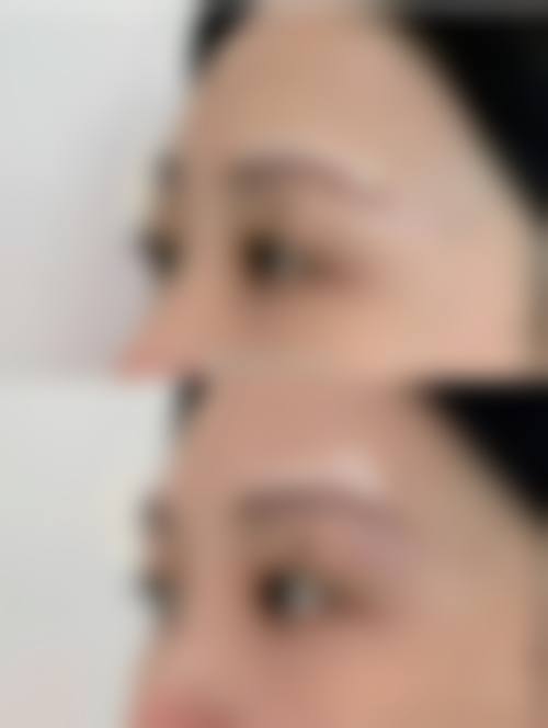 三、815皮肤科诊疗项目有哪些？