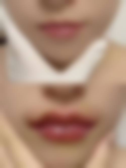 九、新泰市侨艺外科美容诊所真实的患者评价