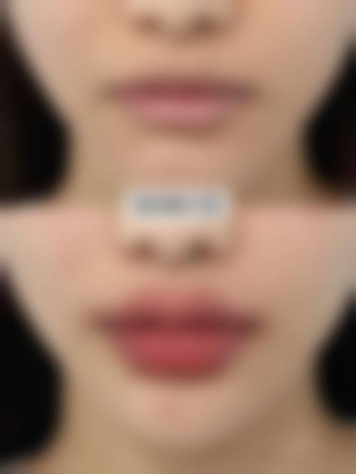 二、新泰市侨艺外科美容诊所怎么样？