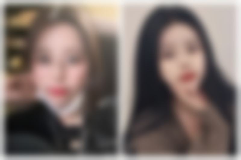 一、抽眼袋多久能修复好：修复时间大揭秘