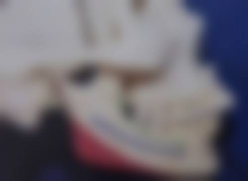 一、为什么双眼皮大眼睛容易有黑眼圈