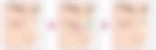 四、隆鼻后化妆洗脸的注意事项