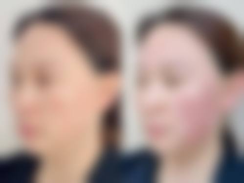 六、杭州滨美医疗美容门诊价格表