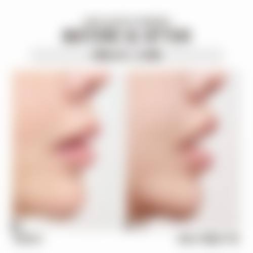 五、浙江大学医学校附属第一医院整形美容科价格表