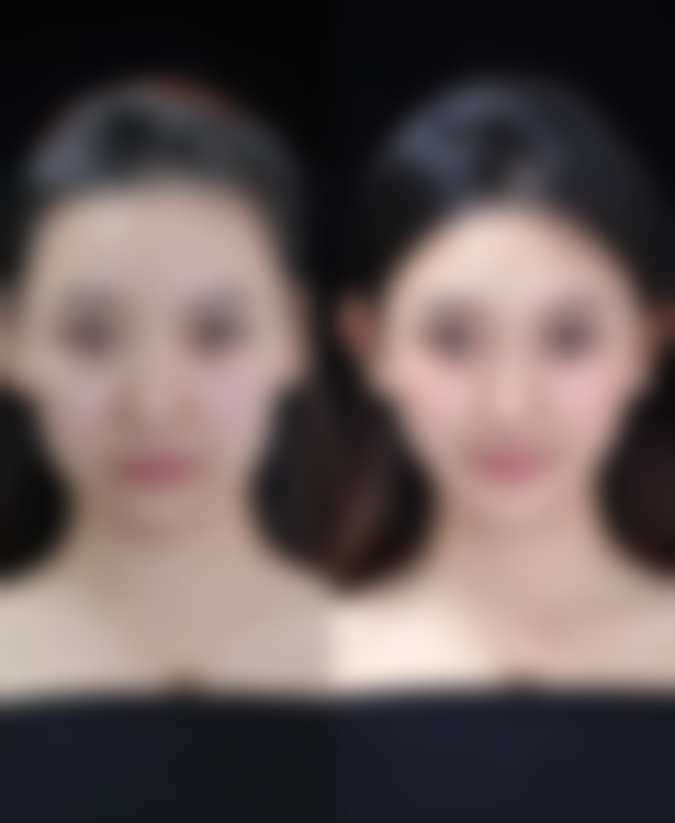 六、日常注意事项：熬夜多了眼袋怎么办，日常细节别忽视