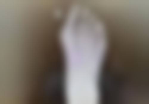 六、日常护理注意事项