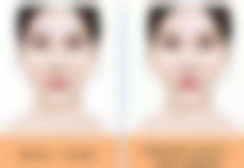 一、头发种植的常见潜在风险